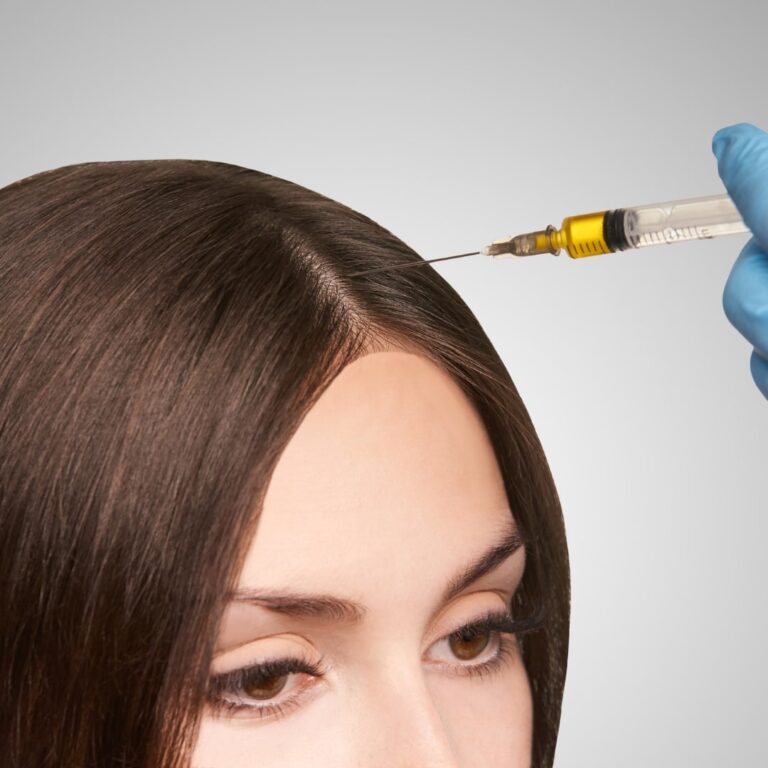 PRP Treatment